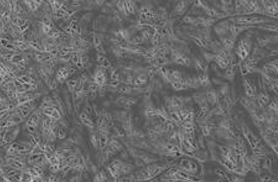 bô lọc sâu 1 micron